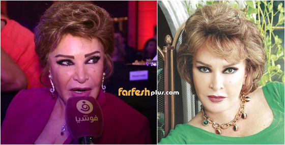 عمليات تجميل سببت تشوهات للنجوم منهم اصالة، حورية فرغلي، هنا الزاهد، ناهد شريف واحمد سعد صورة رقم 5 عمليات تجميل سببت تشوهات للنجوم منهم اصالة، حورية فرغلي، هنا الزاهد، ناهد شريف واحمد سعد صورة رقم 5