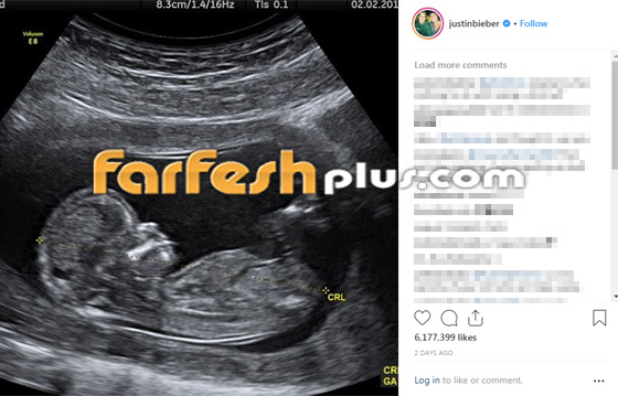 فيديو: جاستن بيبر يعلن حمل زوجته ثم يصفعها في الشارع! ما الحكاية؟ صورة رقم 1 فيديو: جاستن بيبر يعلن حمل زوجته ثم يصفعها في الشارع! ما الحكاية؟ صورة رقم 1