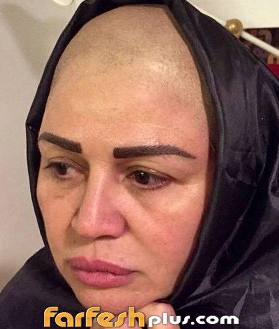 نجمات عربيات وعالميات ظهرن بشعر محلوق (عالزيرو) دعما لمريضات السرطان صورة رقم 3 نجمات عربيات وعالميات ظهرن بشعر محلوق (عالزيرو) دعما لمريضات السرطان صورة رقم 3