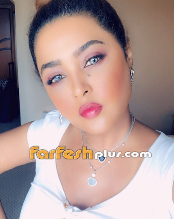 وعد السعودية: طبيبة عراقية شوّهت وجهي.. والشاب الذي احتضنته لم آكله! صورة رقم 9 وعد السعودية: طبيبة عراقية شوّهت وجهي.. والشاب الذي احتضنته لم آكله! صورة رقم 9
