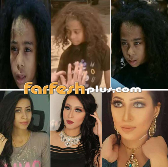 نجوم اختفوا عن الأنظار منذ سنوات.. كيف أصبح شكلهم الآن؟ صورة رقم 3 نجوم اختفوا عن الأنظار منذ سنوات.. كيف أصبح شكلهم الآن؟ صورة رقم 3