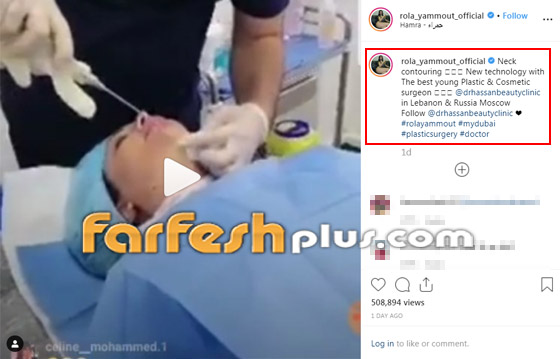 رولا يموت أخت هيفاء وهبي تخضع لعملية، شاهد صورها بدون مكياج صورة رقم 1 رولا يموت أخت هيفاء وهبي تخضع لعملية، شاهد صورها بدون مكياج صورة رقم 1