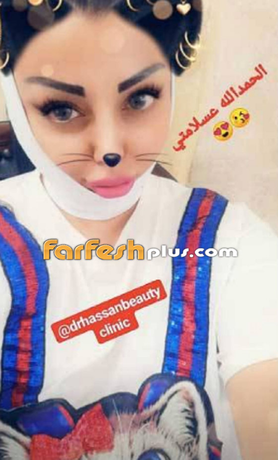 رولا يموت أخت هيفاء وهبي تخضع لعملية، شاهد صورها بدون مكياج صورة رقم 2 رولا يموت أخت هيفاء وهبي تخضع لعملية، شاهد صورها بدون مكياج صورة رقم 2