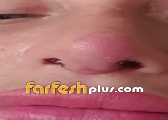 الإعلامية ريهام سعيد تعرض صورها أثناء رحلة مرضها! فيديو صورة رقم 2