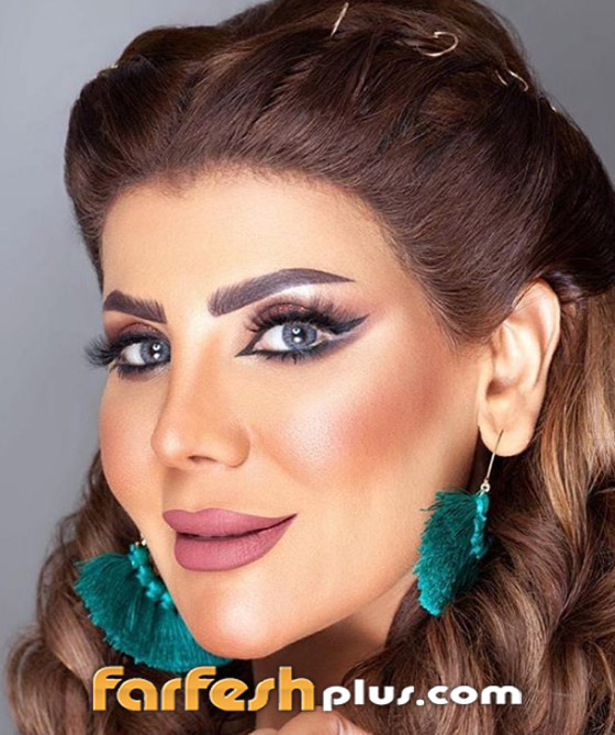 بعد عملية تجميل فاشلة.. الفنانة الكويتية إلهام الفضالة: أنا نادمة! صورة رقم 4 بعد عملية تجميل فاشلة.. الفنانة الكويتية إلهام الفضالة: أنا نادمة! صورة رقم 4