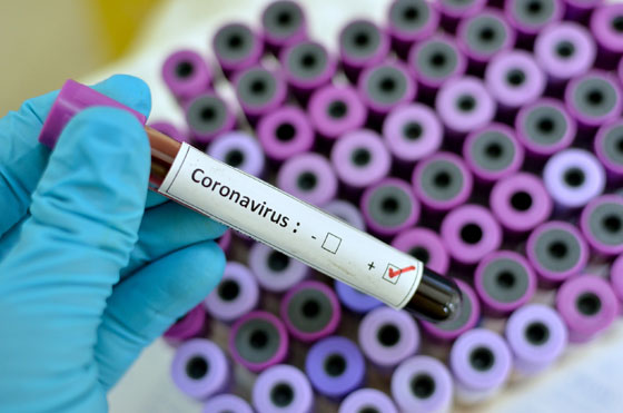  مصر تعلن: هذا هو أول مصاب لدينا بفيروس كورونا صورة رقم 3