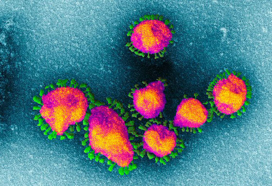  مصر تعلن: هذا هو أول مصاب لدينا بفيروس كورونا صورة رقم 10