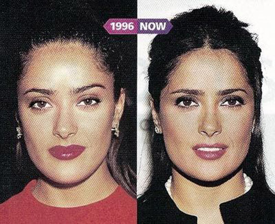  لن تصدقوا كيف كان وجه سلمى حايك قبل عملية تجميل الانف! صور قبل وبعد صورة رقم 5