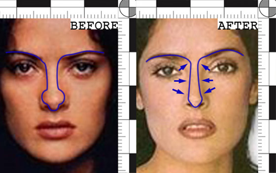  لن تصدقوا كيف كان وجه سلمى حايك قبل عملية تجميل الانف! صور قبل وبعد صورة رقم 1
