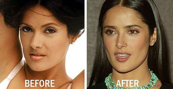  لن تصدقوا كيف كان وجه سلمى حايك قبل عملية تجميل الانف! صور قبل وبعد صورة رقم 2
