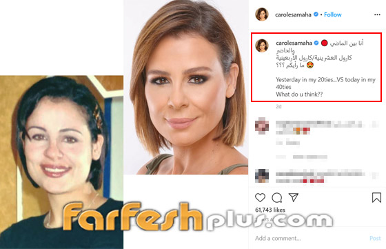 صور كارول سماحة قبل وبعد: هل خجلت من صورها القديمة؟ صورة رقم 1