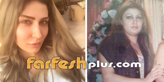 صور قبل وبعد للنجمات تُظهر تأثير عمليات التجميل (المكياج الدائم) صورة رقم 19
