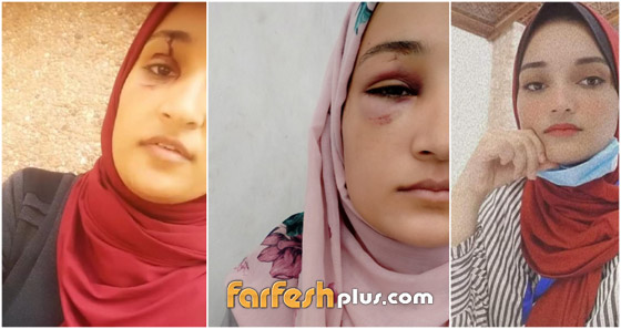 مأساة جديدة في غزة.. اعتداء وحشي على فتاة والفاعل شقيقها صورة رقم 1