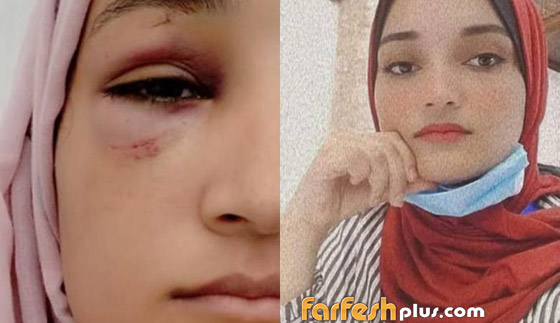 مأساة جديدة في غزة.. اعتداء وحشي على فتاة والفاعل شقيقها صورة رقم 8