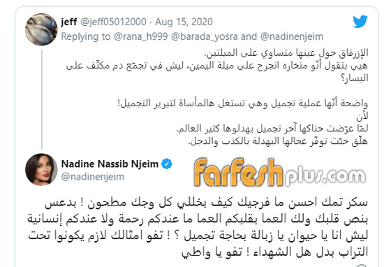 نادين نجيم تنفجر غضبا على متابع اتهمها باستغلال الانفجار للخضوع لعملية تجميل! صورة رقم 1