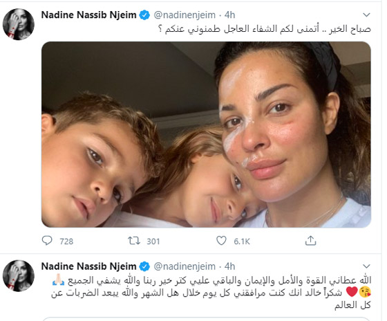 نادين نجيم عن الإنفجار: لم أشاهد سوى الدماء.. وحياتي كانت على المحك صورة رقم 4
