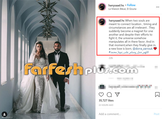 أول تعليق من هاني سعد على الشائعات بعد زواجه من درة.. والفنانة ترد صورة رقم 1