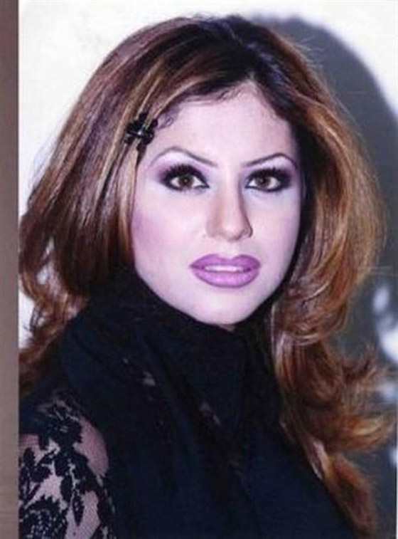 حليمة بولند أجرت أكثر من 13 عملية تجميل.. شاهدوا كيف تغيّرت ملامحها كثيراً! صورة رقم 4