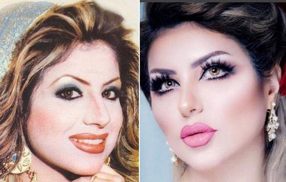 حليمة بولند أجرت أكثر من 13 عملية تجميل.. شاهدوا كيف تغيّرت ملامحها كثيراً! صورة رقم 6