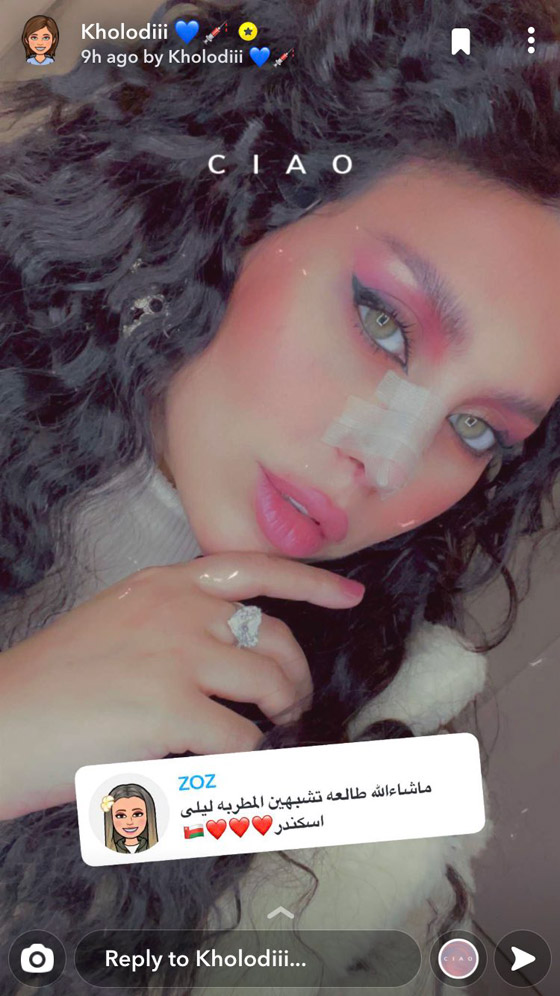 الدكتورة خلود قبل وبعد.. كيف تحولت الى هيفا ماجيك؟ صورة رقم 4