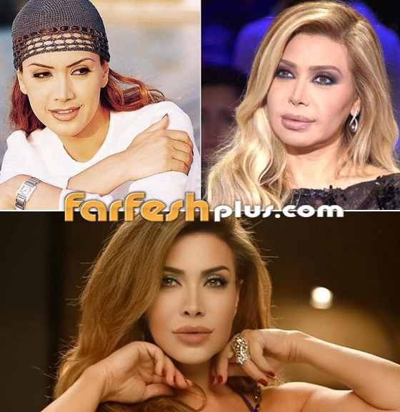 صور: كيف أفسدت عمليات التجميل شكل هؤلاء النجمات وخسرن الشهرة فجأة؟ صورة رقم 3