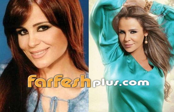 صور: كيف أفسدت عمليات التجميل شكل هؤلاء النجمات وخسرن الشهرة فجأة؟ صورة رقم 4