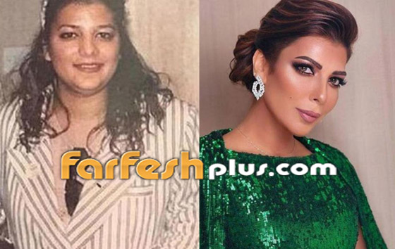 صور: كيف أفسدت عمليات التجميل شكل هؤلاء النجمات وخسرن الشهرة فجأة؟ صورة رقم 6