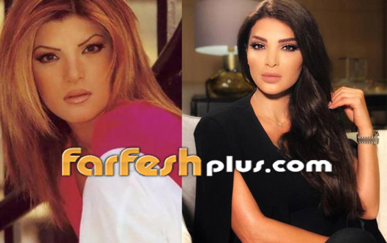 صور: كيف أفسدت عمليات التجميل شكل هؤلاء النجمات وخسرن الشهرة فجأة؟ صورة رقم 7