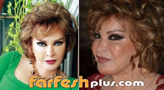 صور: كيف أفسدت عمليات التجميل شكل هؤلاء النجمات وخسرن الشهرة فجأة؟ صورة رقم 9