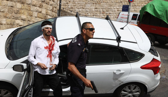 فيديوهات صادمة: بعد اقتحام شرطة إسرائيل للمسجد الأقصى، مستوطن يدهس مصلين ويقول: هم رجموني بالحجارة صورة رقم 6