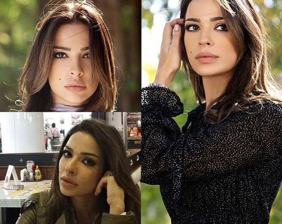 فيديو وصور نادين نجيم قبل وبعد: الجمهور مصدوم! تغييرات واضحة تكشف كثرة عمليات التجميل صورة رقم 13