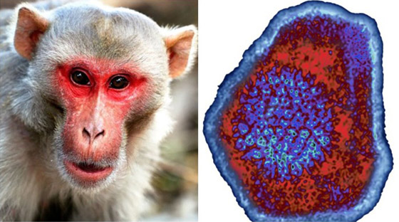 الخبراء يحذرون بأن القادم أسوأ حول مرض جدري القرود! صورة رقم 3