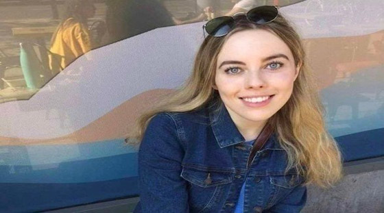 حالة نادرة تهدد شابة بانفصال جمجمتها عن جسمها صورة رقم 1