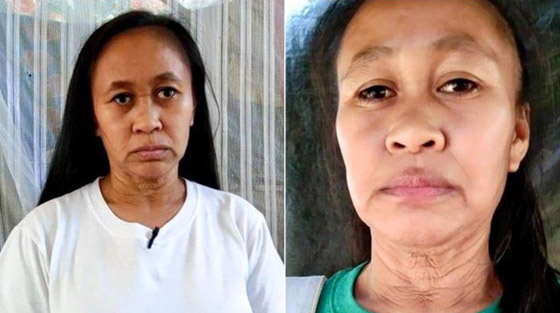 حالة نادرة.. فتاة فلبينية بعمر 16 عاما بوجه امرأة في سن الـ50! صورة رقم 2