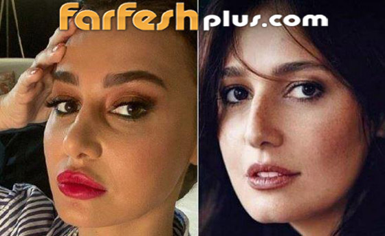 صور قبل وبعد: 15 فنانة اعترفن بإجراء عمليات تجميل غيرت شكلهن كليا صورة رقم 11