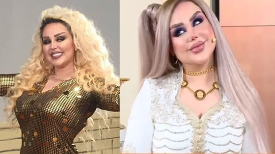 صور صادمة: داليا نعيم بعد عملية تجميلية، شفاهها مخيفة والجمهور: فيلم الرعب!! صورة رقم 4