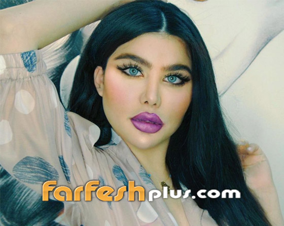 تداول صورة لـ إنجي خوري قبل التجميل والفنانة السورية ترد صورة رقم 16