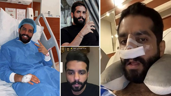 قائمة بالمشاهير الذين خضعوا لعمليات تجميل في 2022 صورة رقم 1