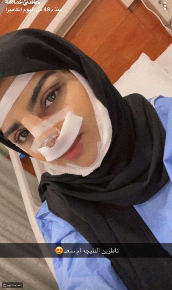 قائمة بالمشاهير الذين خضعوا لعمليات تجميل في 2022 صورة رقم 2