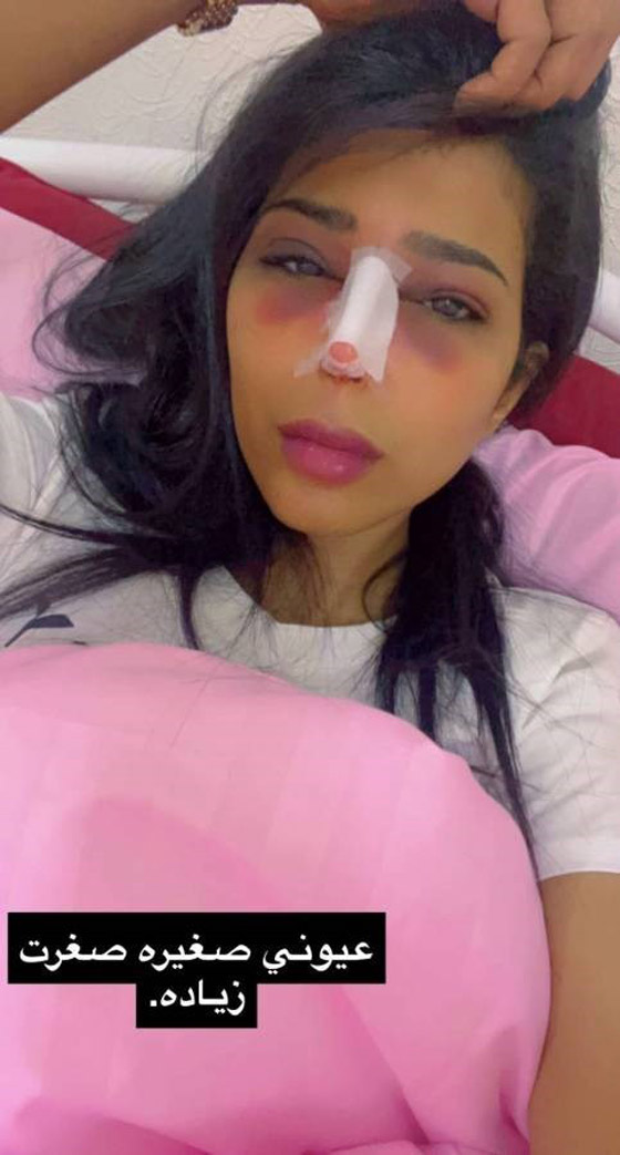 قائمة بالمشاهير الذين خضعوا لعمليات تجميل في 2022 صورة رقم 7