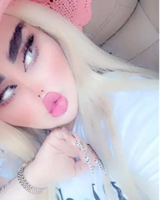 صور داليا نعيم العراقية تصدم المتابعين بعد عملية تجميل جديدة! صورة رقم 2