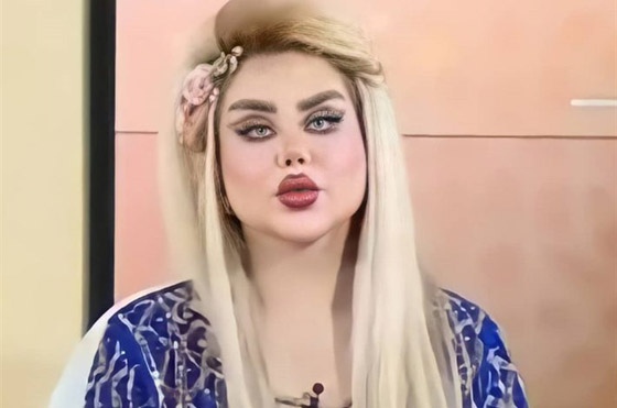 صور داليا نعيم العراقية تصدم المتابعين بعد عملية تجميل جديدة! صورة رقم 3