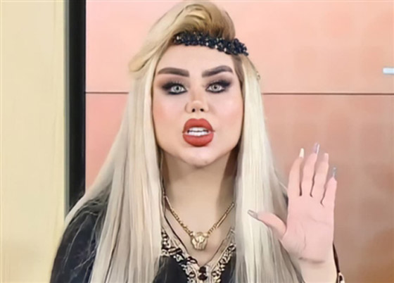 صور داليا نعيم العراقية تصدم المتابعين بعد عملية تجميل جديدة! صورة رقم 4