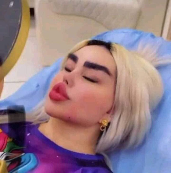 صور داليا نعيم العراقية تصدم المتابعين بعد عملية تجميل جديدة! صورة رقم 5