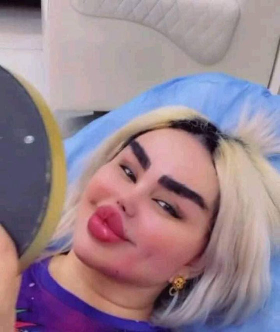 صور داليا نعيم العراقية تصدم المتابعين بعد عملية تجميل جديدة! صورة رقم 6