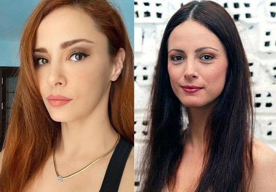 نجمات تركيا قبل وبعد التجميل.. لن تصدق الفرق! صورة رقم 7