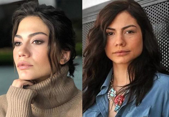 نجمات تركيا قبل وبعد التجميل.. لن تصدق الفرق! صورة رقم 9