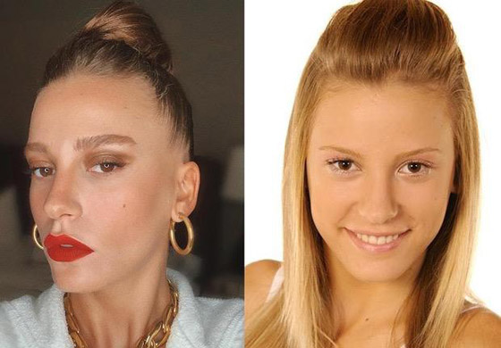 نجمات تركيا قبل وبعد التجميل.. لن تصدق الفرق! صورة رقم 10