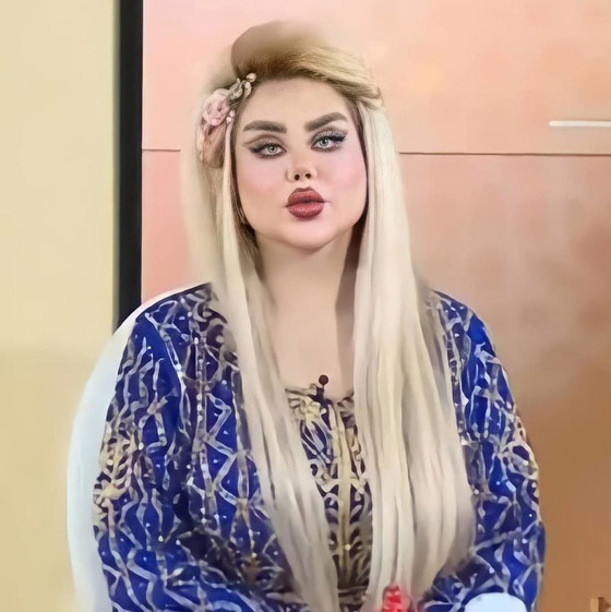 فيديو وصور داليا نعيم بعد التجميل! وملك جمال لبنان يرد: هذا غش واعتداء على ربنا!  صورة رقم 1