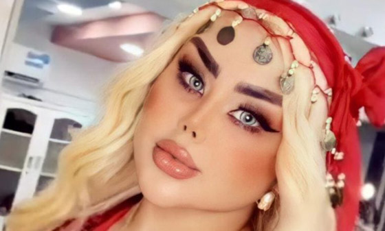 فيديو وصور داليا نعيم بعد التجميل! وملك جمال لبنان يرد: هذا غش واعتداء على ربنا!  صورة رقم 2